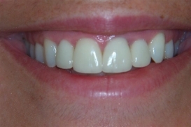 case_1_image_82.JPG"