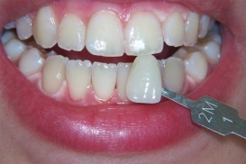 case_1_image_91.jpg"