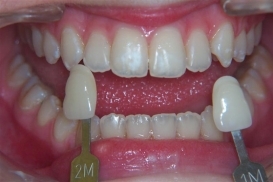 case_1_image_92.JPG"