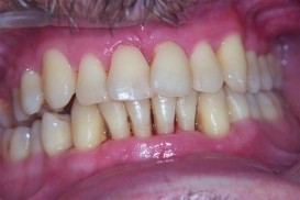 case_1_image_96.JPG"
