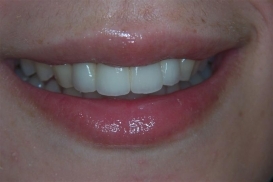 case_1_image_98.JPG"
