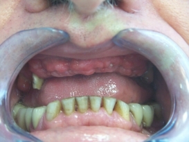 case_0_image_22.jpg"