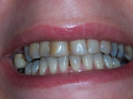 case_0_image_27.JPG"
