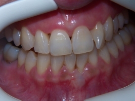 case_0_image_34.jpg"