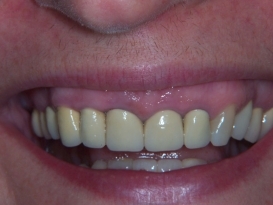 case_0_image_40.JPG"