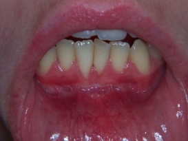 case_1_image_25.JPG"