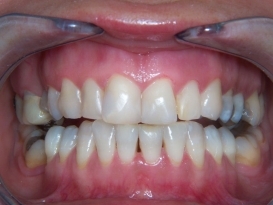case_1_image_27.JPG"