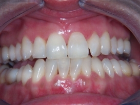 case_1_image_34.jpg"